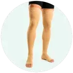 واریس