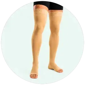 واریس