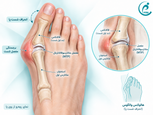 آناتومی هالوکس